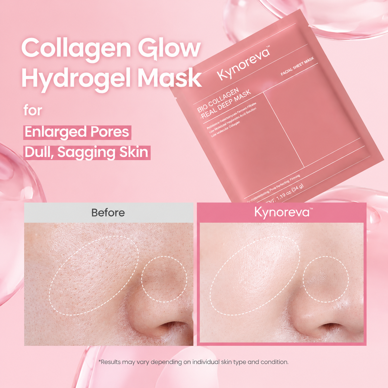Hydrogel Collagen Facial Mask – Deep Hydrating & Skin Barrier Repair Sheet Mask for Smooth, Radiant Skin - Image 5